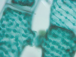 MISSING THUMBNAIL